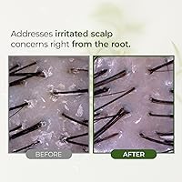 STEAMBASE Tea Tree Scalp Treatment 8.42 fl oz — image 5