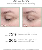 BIOEFFECT EGF Eye Serum with De-Puffer Rollerball — image 3