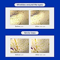 IOPE Retinol Serum in Deep Collagen Gel Mask 5+1 Set — image 4