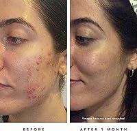 HERBIVORE Blue Tansy BHA & Enzyme Pore Refining Mask 60mL — image 5