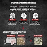 Zenotri Biotin and Zinc Pyrithione Shampoo 300mL — image 8