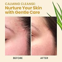 Honeyskin Face and Body Wash with Manuka Honey, 16oz — image 6