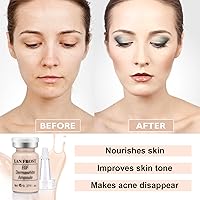 TRESSON BB Pigment Serum Starter Kit No. 1 — image 5