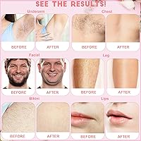 OudaHeat 3.3 lb Pink Hard Wax Beads for Hair Removal — image 5