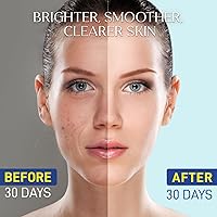 Enaskin Niacinamide Serum 15% for Face 1.7 Fl Oz — image 4