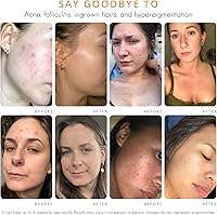 AlmondClear Face & Body Clearing Serum Level 1 - 1 fl oz — image 5