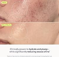 Skinfix Skin Barrier Restoring Gel Cream 1.7 oz — image 4