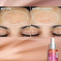 StriVectin Multi-Action Super C Retinol Brightening & Correcting Serum 1.7oz — image 7