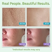 YEOUTH Skin Care Set for Teens — image 5