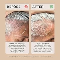 ACTIIV Thickening Hair Serum 1.8oz — image 7