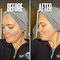 Divine Derriere Glycolic Acid Peel 40% for Face — image 7