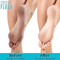 Crystal Flush Foot Soak with Apple Cider Vinegar, Tea Tree Oil & Pink Himalayan Salt 16oz — image 7