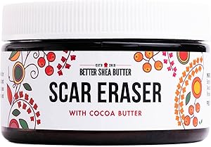 Better Shea Butter Scar Eraser Balm 4 oz Review