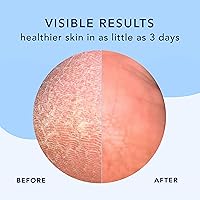 Barefoot Scientist High Dive Foot Therapy Cream 8oz — image 3