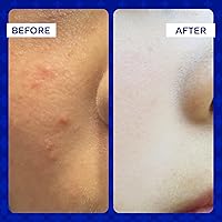 Emuaid Clear + Repair Hypochlorous Acid Skin Spray, 59mL — image 5