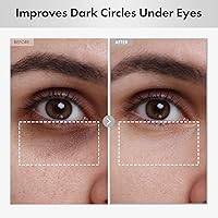 NatureKind Hyaluron Lifting Eye Cream 15ml — image 3