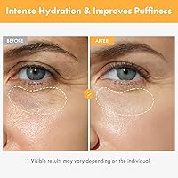 TOSOWOONG VITA Clinic Vitamin Eye Cream 15ml — image 2