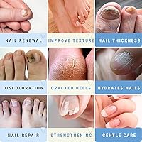 Urea 50% Nail Gel — image 4