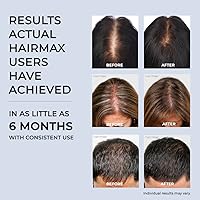 HairMax Laser Band 41 — image 8