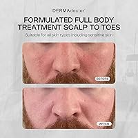 DERMAdoctor Tranquility Cleanser 2% Pyrithione Zinc 7.1oz — image 3