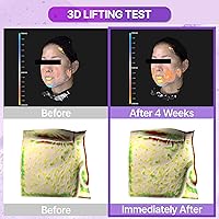 BIOHEAL BOH Probioderm 3D Lifting Essential Toner 150mL — image 3