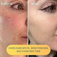 KOA LIFE Facial Oil and Vitamin C Serum 0.5 Fl OZ — image 3