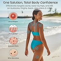 Vanibiss Butt & Thighs Acne Treatment Cream 4oz — image 3