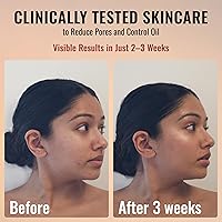 Amour De Moi Anti Aging Pure Retinol Serum 1oz — image 3