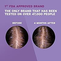 Rogaine Women's 2% Minoxidil Topical Solution, 3-Month Supply — image 2