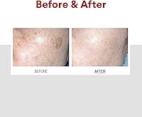 Medi-Peel Melanon X Cream 1.01oz — image 7