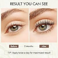 Simpout Eyelash Growth Serum - 1.06oz — image 4