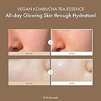 Dr.Ceuracle Vegan Kombucha Tea Essence 150mL — image 2