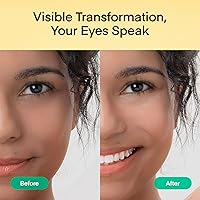 Terez & Honor Under Eye Patches - 180 Pcs — image 7