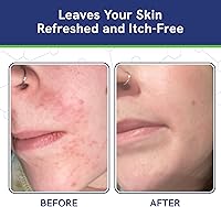 pHat 5.5 Itch Cream 4oz — image 6