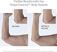 StriVectin Tighten & Lift Crepe Control Body Cream 5oz — image 10