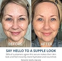 goPure Hyaluronic Acid Serum 1 fl oz — image 4