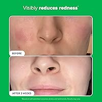 Paula's Choice BOOST 10% Azelaic Acid Booster — image 6