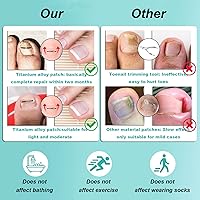 Twoant Titanium Alloy Ingrown Toenail Treatment Kit (9PCS) — image 5