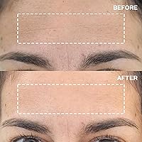 Wrinkles Schminkles Forehead Wrinkle Patches 2 Pack — image 3