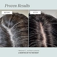 Arey To The Root Hair Serum for Women & Men, 2.2oz — image 3