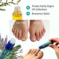 Swissklip KlearNail Toenail Stick 10mL — image 3