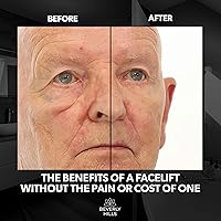 Beverly Hills Mens Instant Facelift and Eye Serum Treatment — image 3