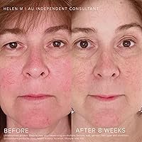 Rodan and Fields Soothe Regimen for Sensitive Skin — image 3