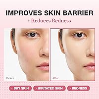 Physiogel Redness Reducing Cream 5.07oz — image 2