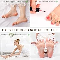 HLOES Toe Spacers for Women and Men - 2PCS — image 7