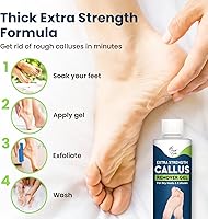 Foot Cure Callus Remover Gel & Pumice Stone Set — image 2