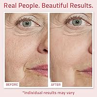 YEOUTH Retinol Serum for Face with Hyaluronic Acid & Vitamin E 2oz — image 4