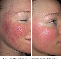 Bioelements Barrier Fix Daily Hydrator 1.7oz — image 6