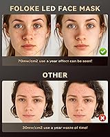 FOLOKE LED Light Therapy Mask — image 7