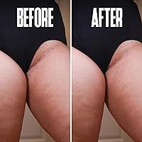 Divine Derriere Ingrown Hair Pads – 50 Pads — image 7